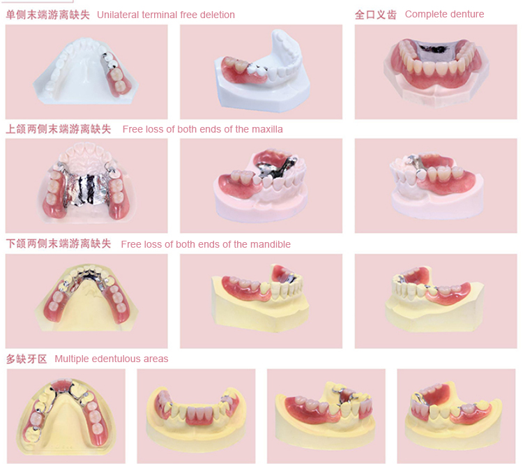 AX-YD-2 FlexSoft Partial Dentures Materials